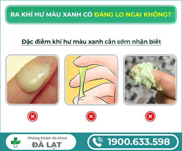 Hình ảnh minh họa